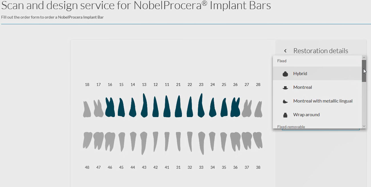NobelProcera Services Workflow for Implant Bar Overdenture