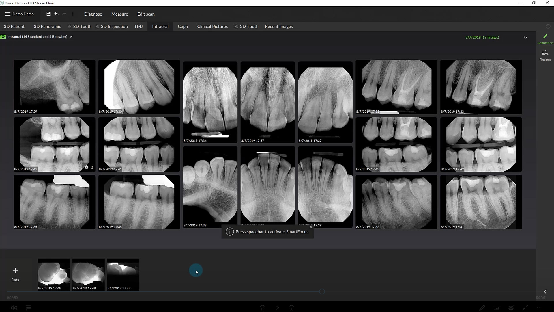 Intraoral Workspace, Full Mouth Series