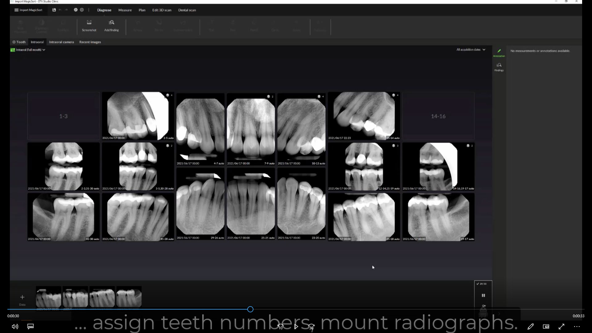 Importing Intraoral X-Ray Images with MagicSort