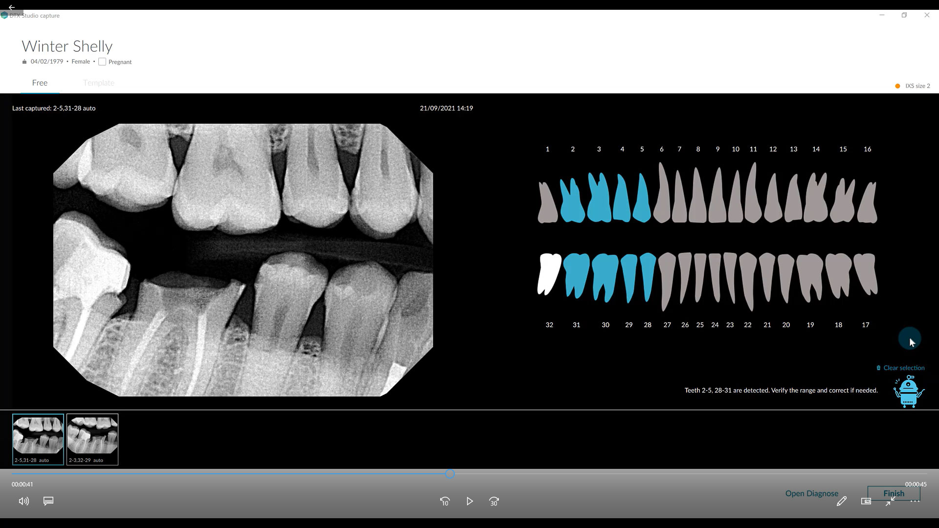 Capturing Intraoral X-Ray Images Utilizing MagicSort