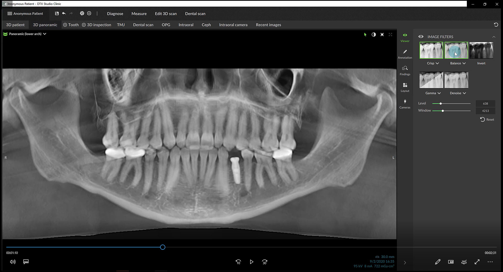 Generate a Pan from a 3D CBCT Image
