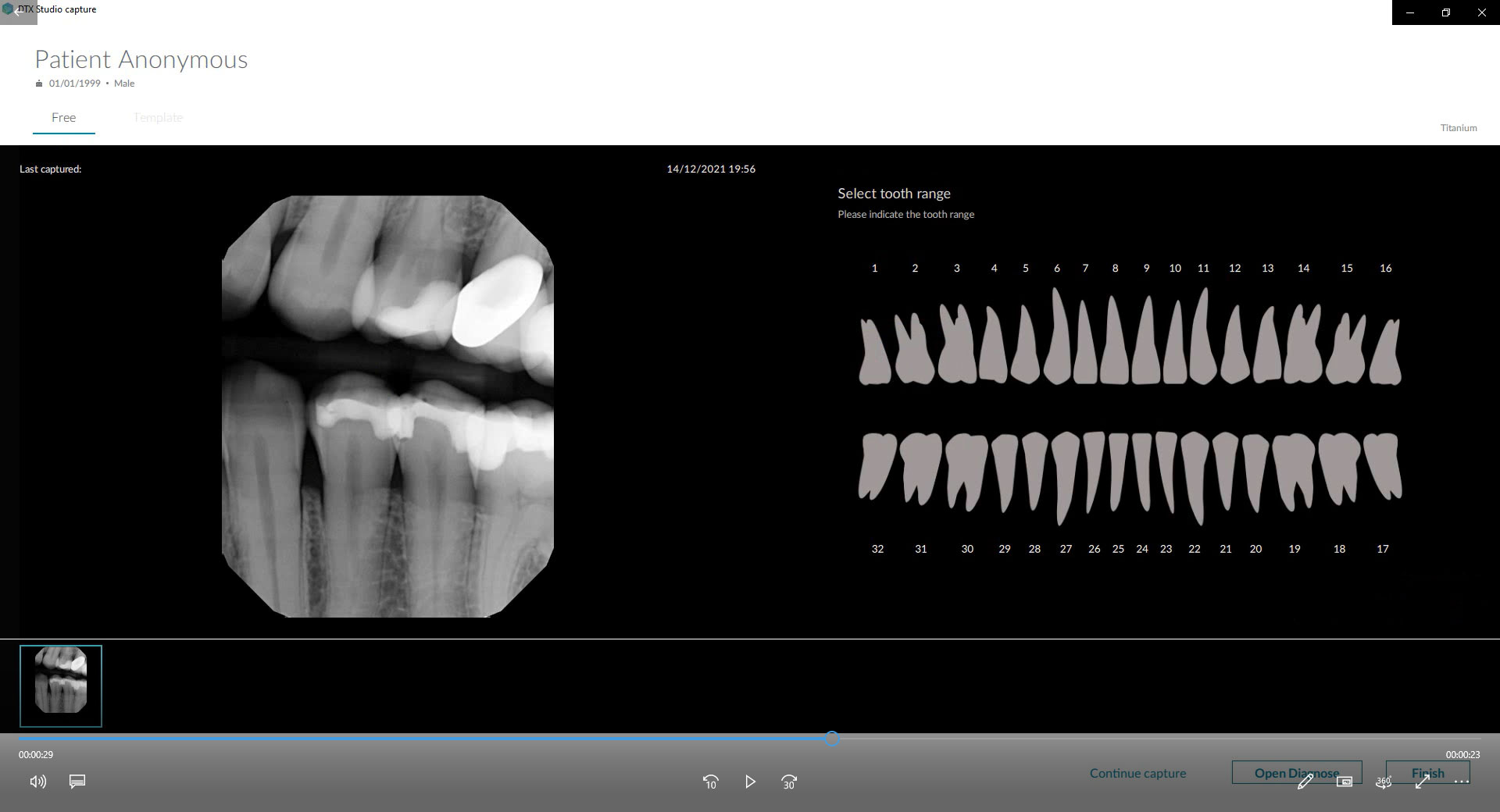 Autorotation of Acquired Intraoral X-Ray Images