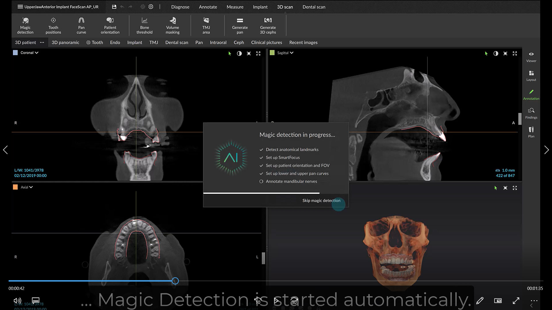 Automatic Initialization of CBCT Images