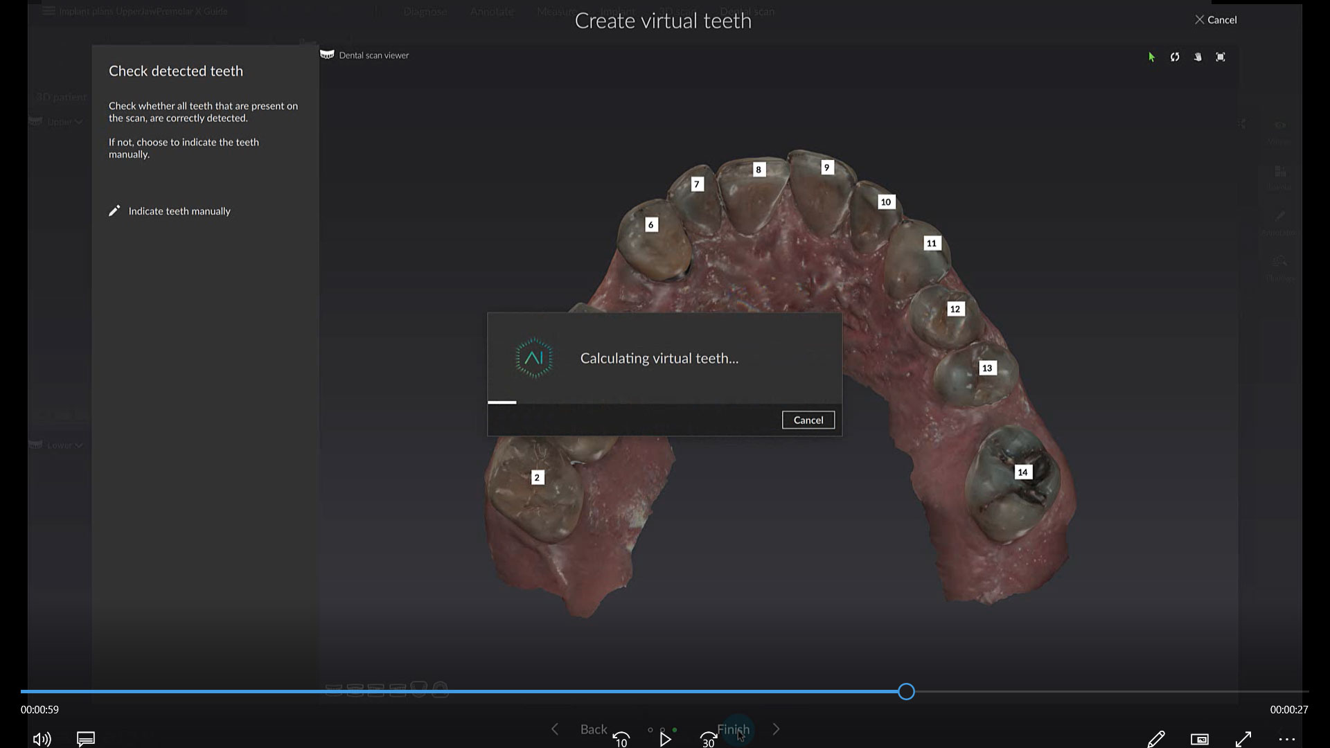 Create Virtual Teeth with SmartSetup