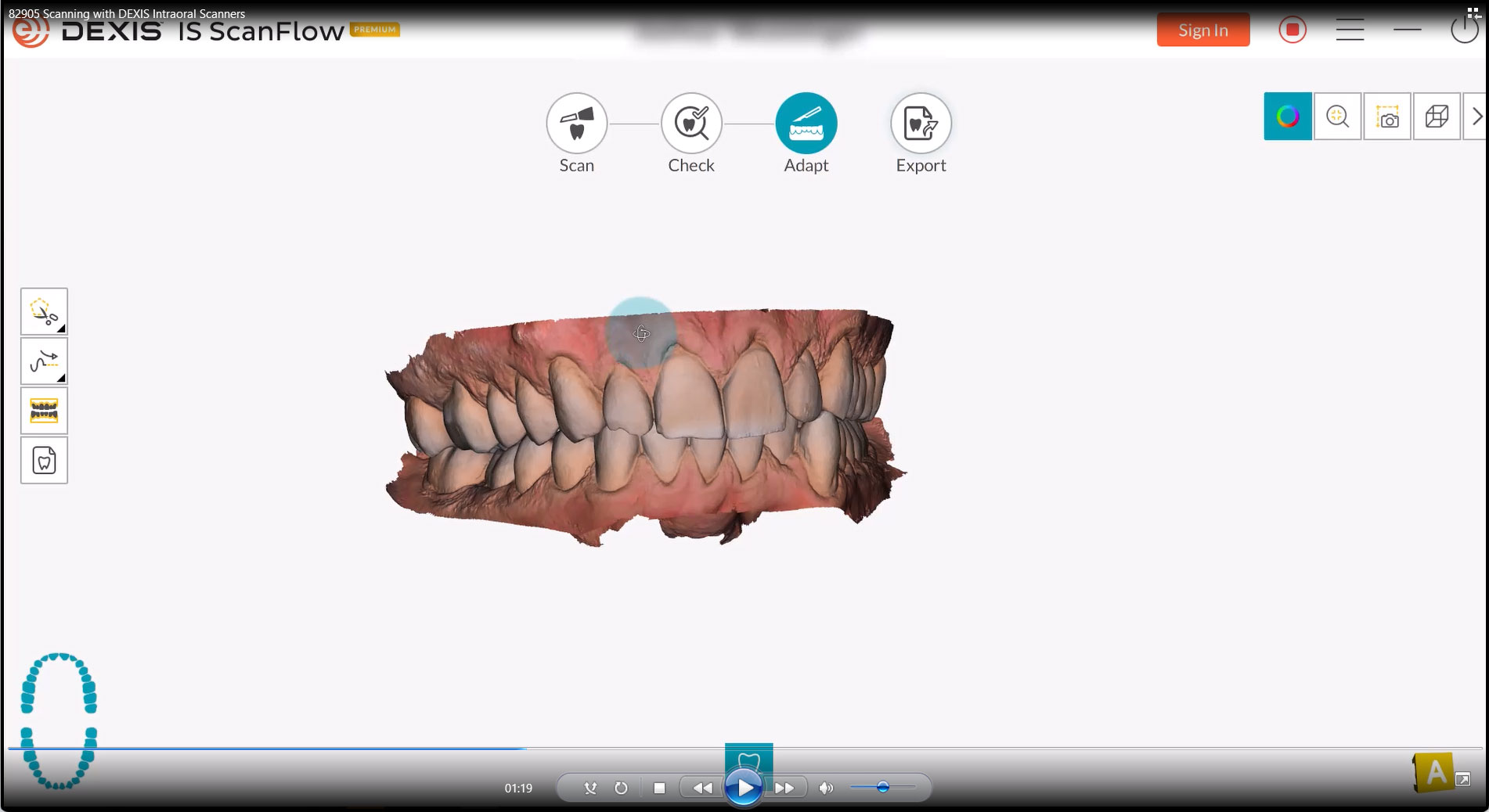 Scanning with DEXIS Intraoral Scanners