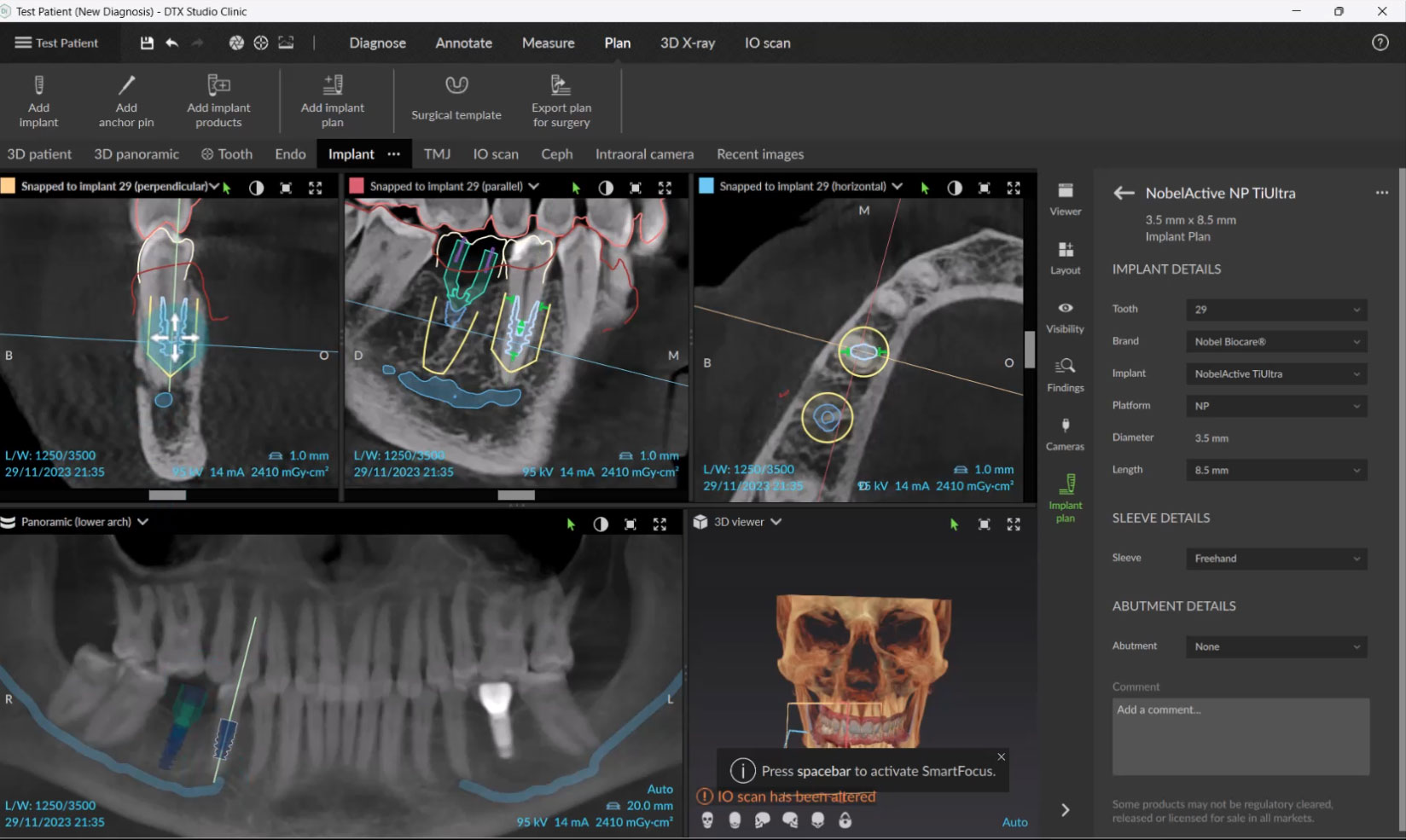 Implant Planning Workflow for DEXIS™ Scanners