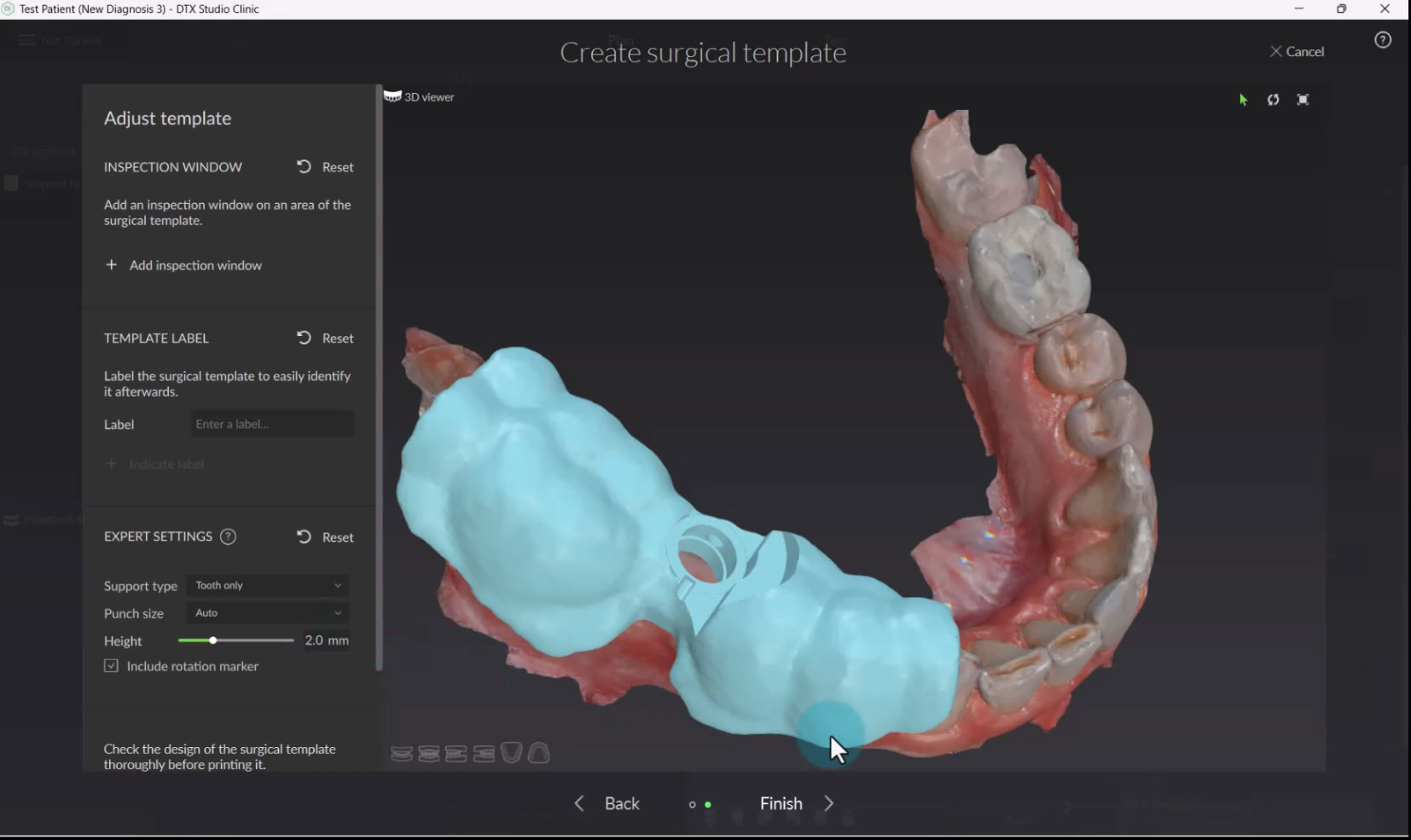 Expert Settings for Surgical Templates