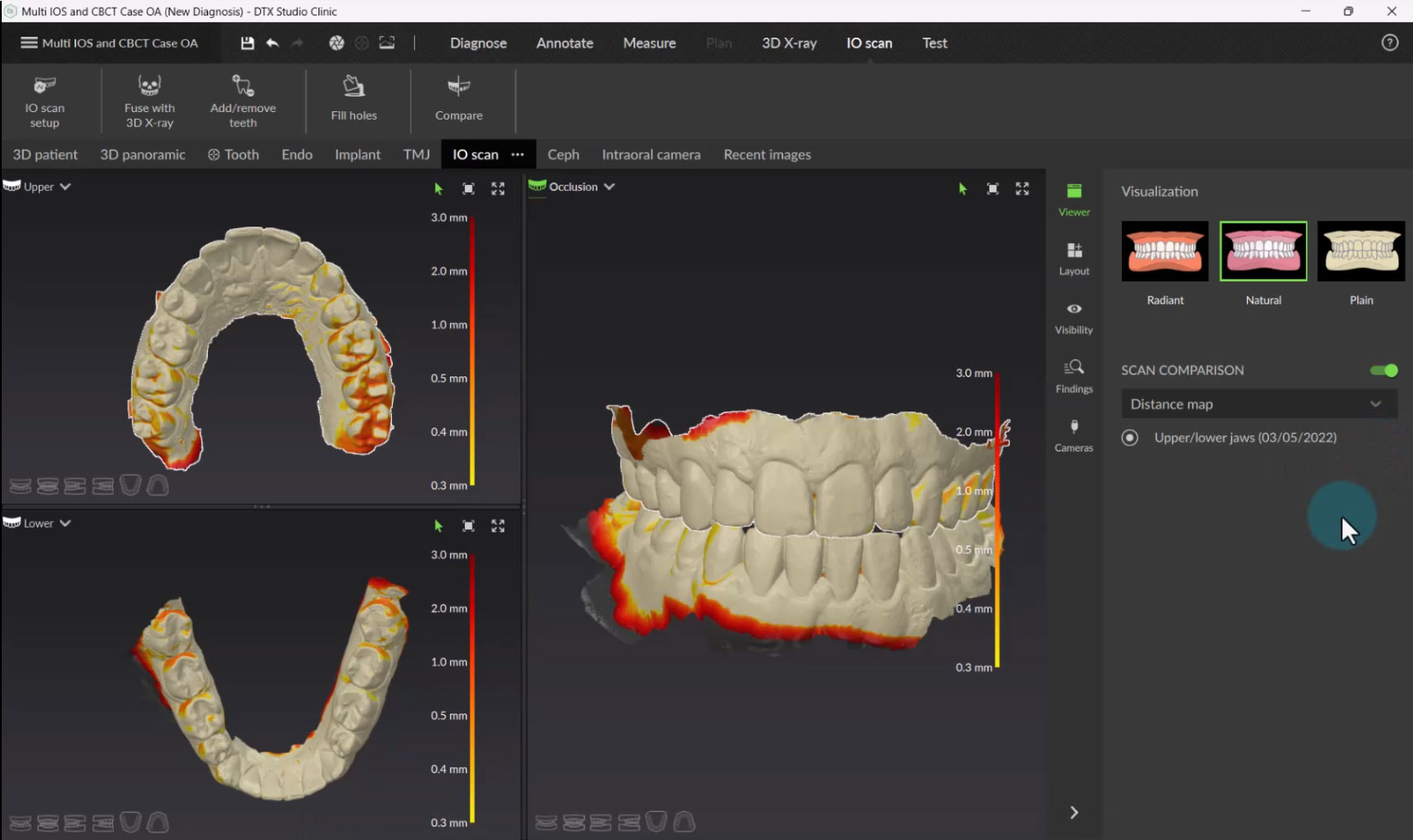 compare intraoral scans