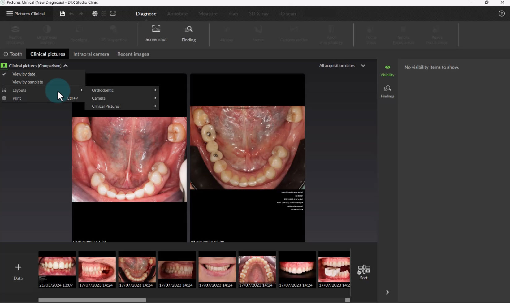 clinical pictures