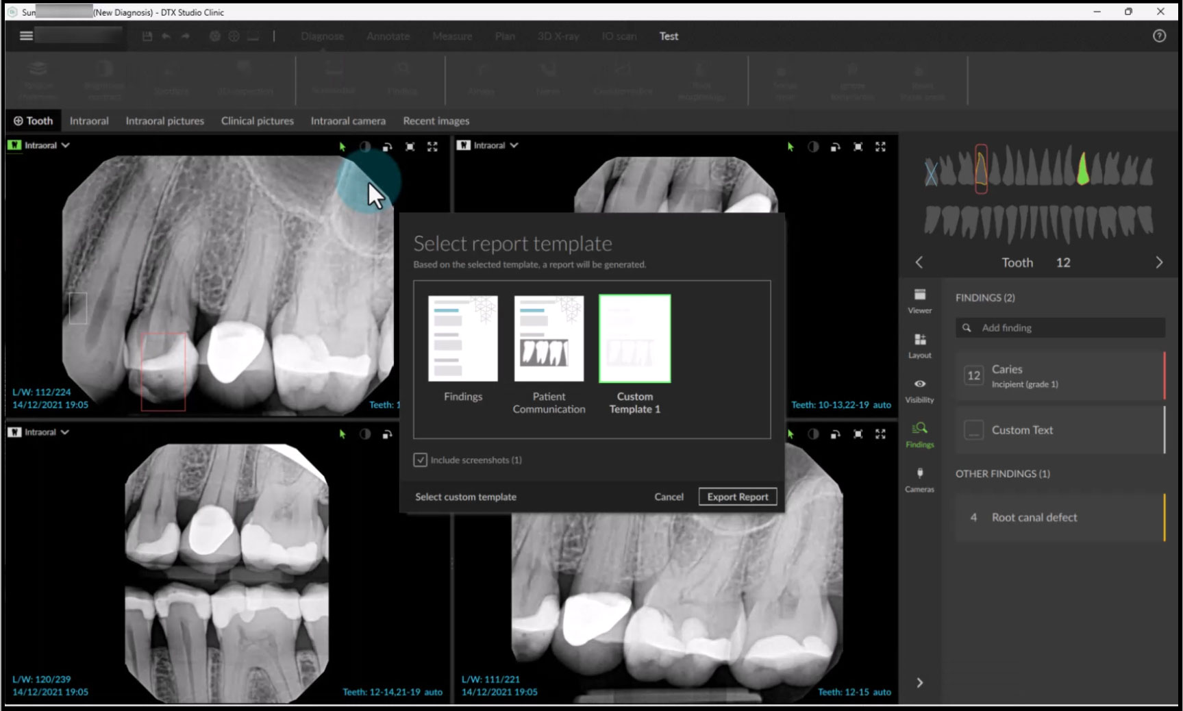 Custom Reports