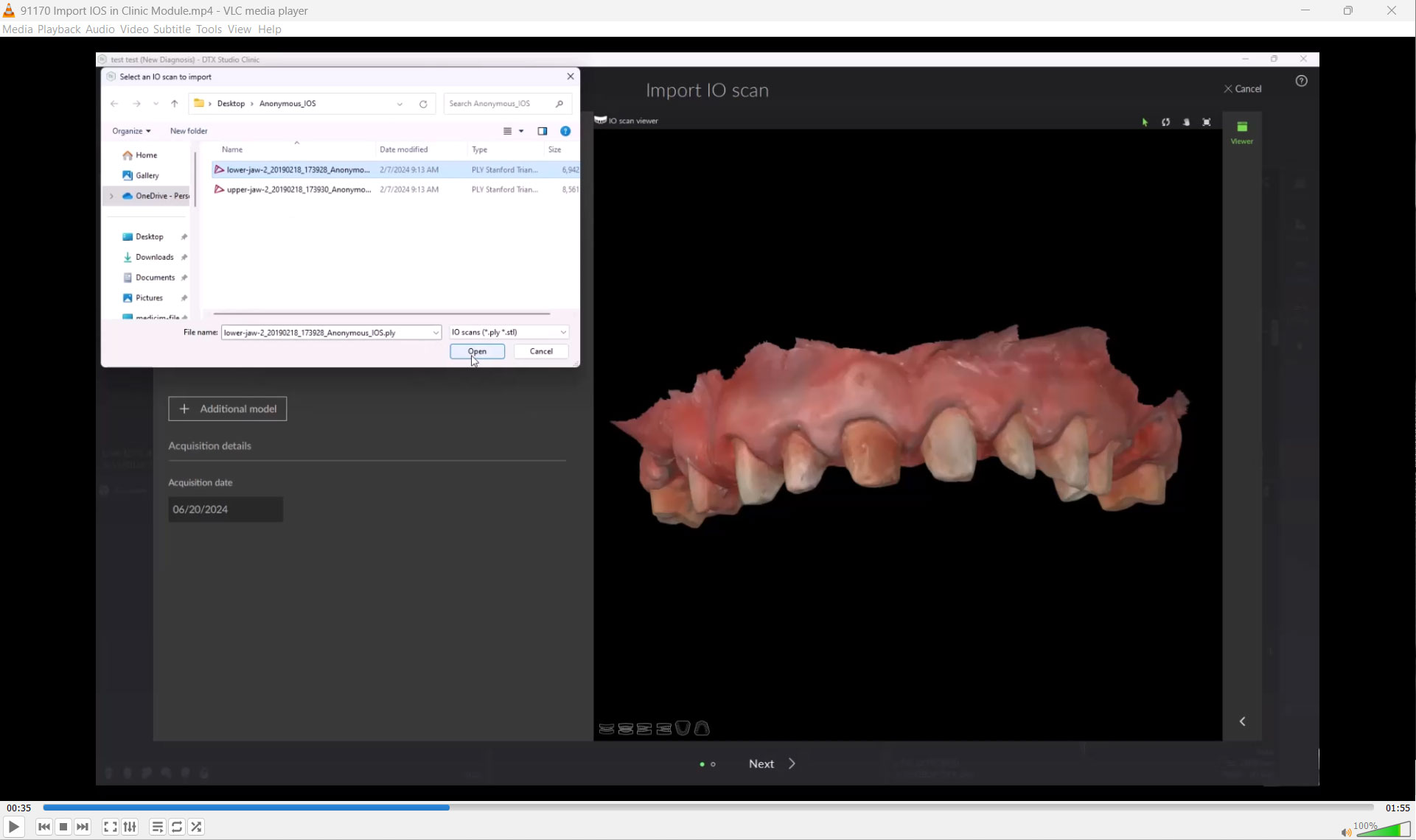 Import Intraoral Scans in the Clinic Module