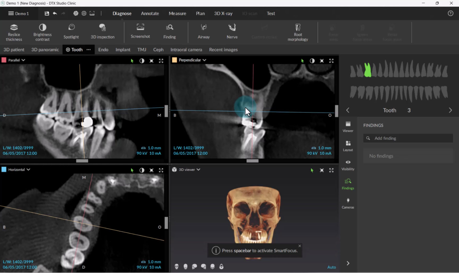 Working with 3D CBCT Images (MagicAssist)