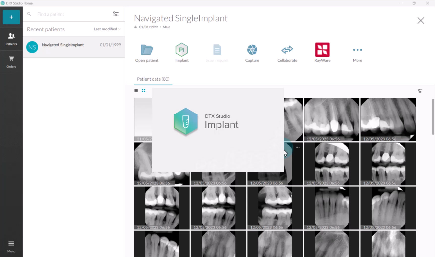 Export to DTX Studio Implant