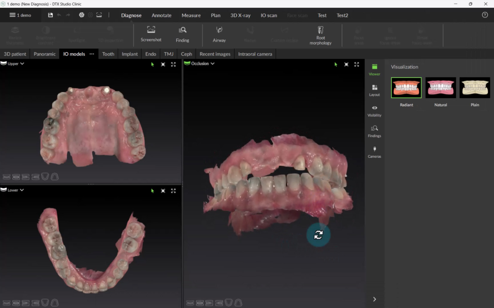 Working with IO Scans